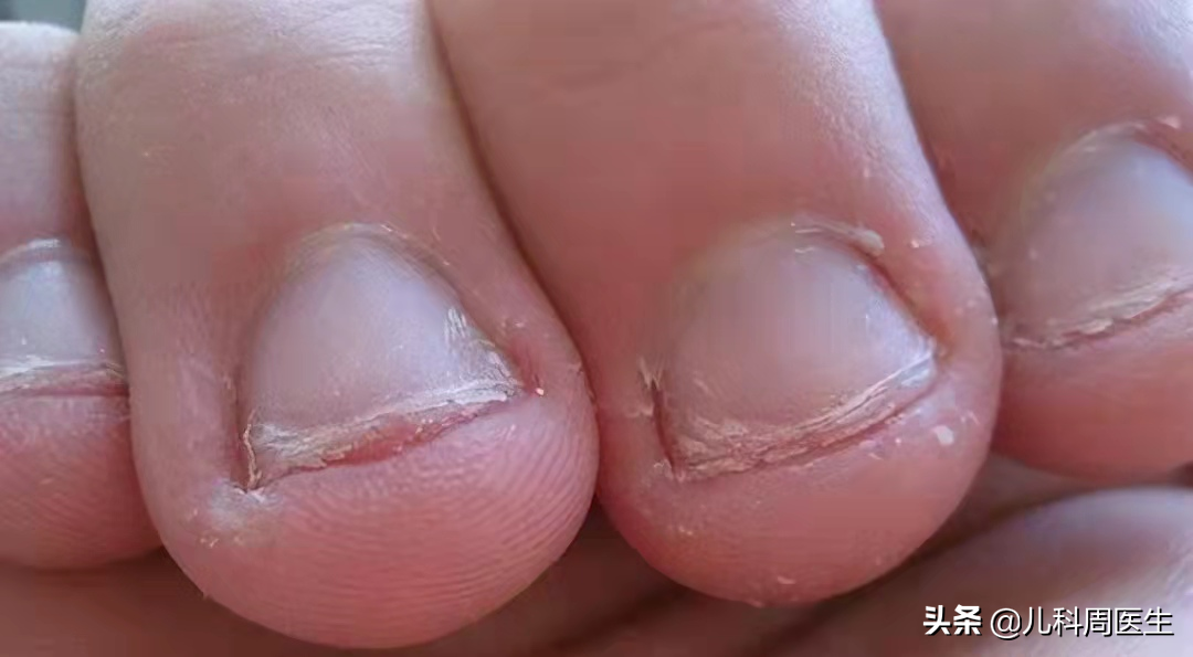 孩子“啃手指”不好改正，该让缺锌缺钙背锅吗？解决安全感很重要
