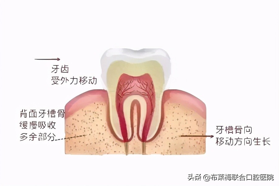 牙齿矫正，你所关心的那些问题