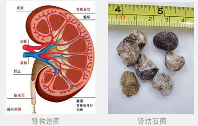 左侧腹部疼，是哪些病造成的？去医院做什么检查？医生告诉你