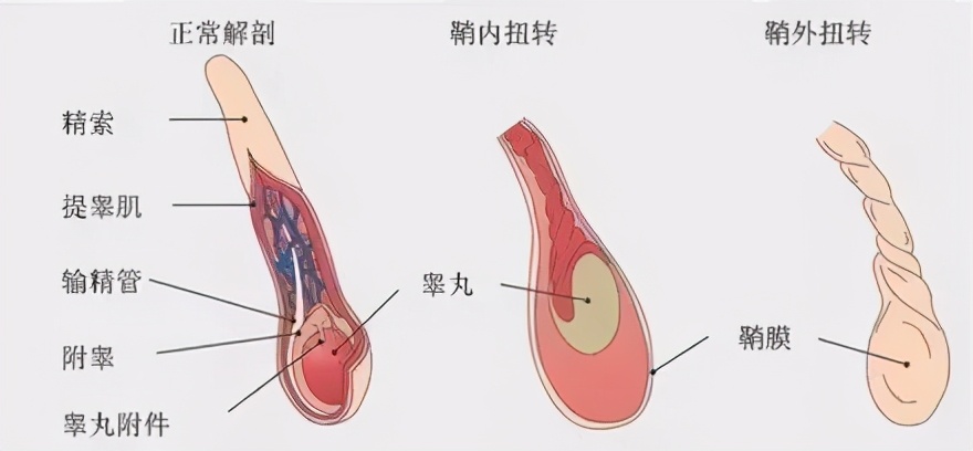 “蛋蛋疼”千万别大意！妈妈做了一件事保住了儿子的“下半身”
