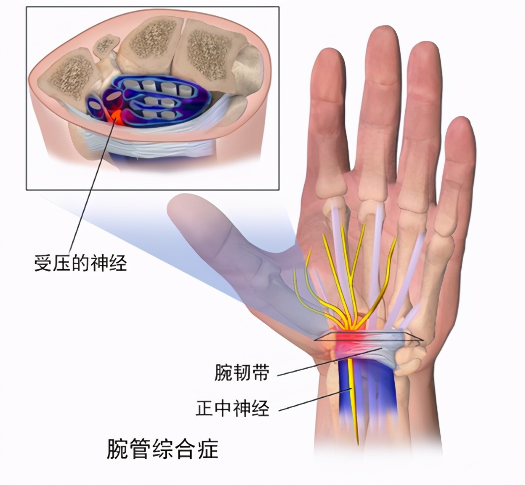 经常手麻、手痛，是血液循环不畅吗？不出意外，这5种可能性较大