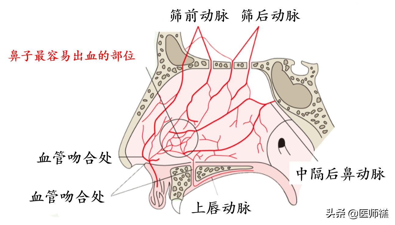无缘无故流鼻血？以下一些健康问题，医生希望你一定要明白