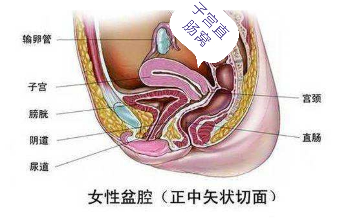 女性之痛:不是每一种积液都是病,这种情况不用打针吃药