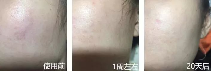 女神李冰冰私藏的补水减龄神器，用完皮肤超好，素颜也敢出门