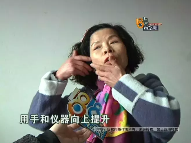 明明去买电饭锅,结果被老板娘带去工作室“祛皱”,花了1万多