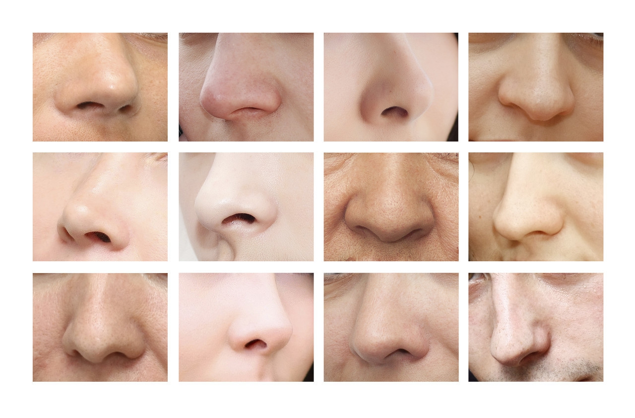 单纯隆鼻和鼻综合有什么区别？为什么价格差这么多？