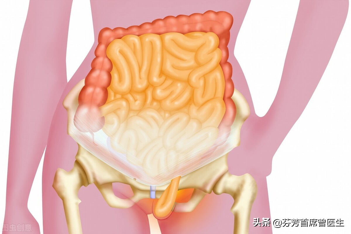 小肠坏死有多可怕？出现腹痛不一定是老胃病，医生：还可能是疝气