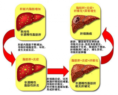 肝脏在身体什么部位，肝脏有什么功能？