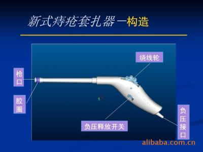 内痔套扎术治疗效果显著，微创手术过程详解