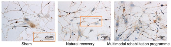 海南医学院第一附属医院发表的SCI因图片疑似重复被质疑