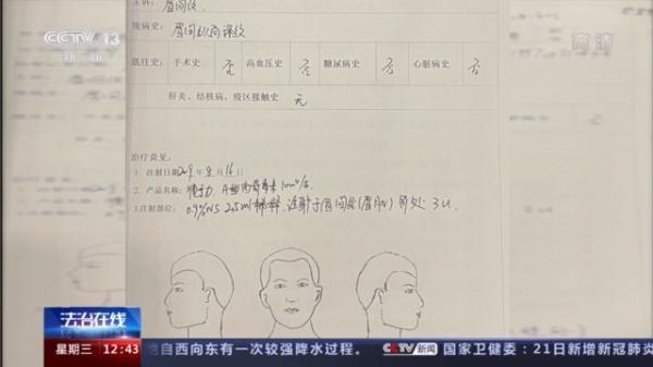 “美丽贷”并不美丽！想要高薪工作先贷款整容？你已落入骗子的圈套「网警转发」