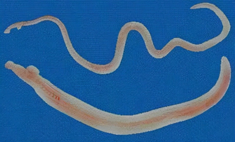 而人体排出的粪便当中,会含有很多细菌,病毒和寄生虫,如果排便之后