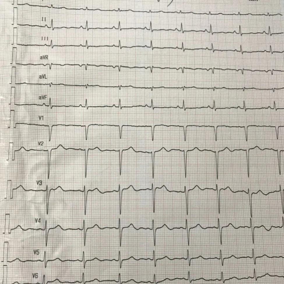 同学父亲腹痛消瘦做胃镜，结果一出来抱头痛哭，“我该早来的”