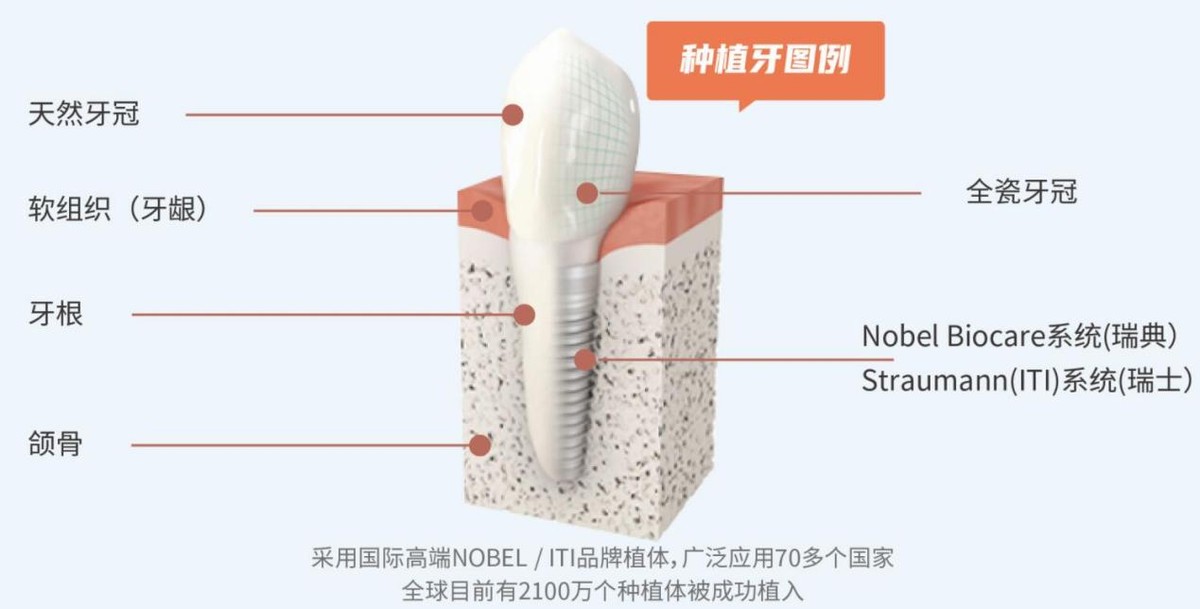 张淼保险工作室：齿科保险，击穿行业底价的性价比之王来了