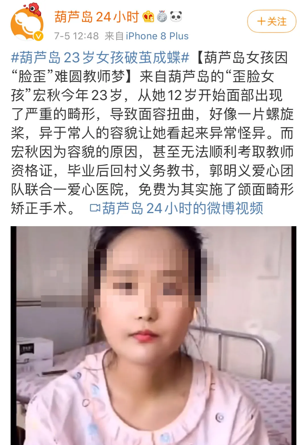 因“脸歪”难圆教师梦，术后逆袭变女神：感觉以后人生都不一样了