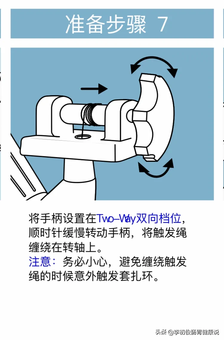 一次肠镜操作,一举三得同时完成肠道检查、套扎止血、消除内痔!