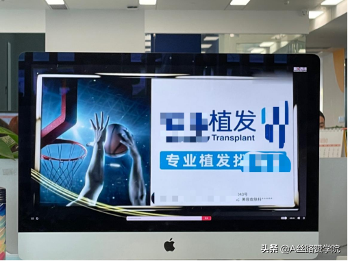 “头等大事”！浅谈医药行业-植发子赛道市场