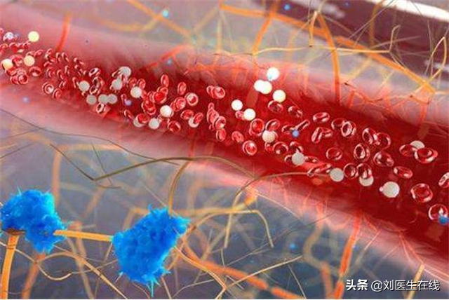 高密度脂蛋白偏高与低密度脂蛋白异常的关联分析