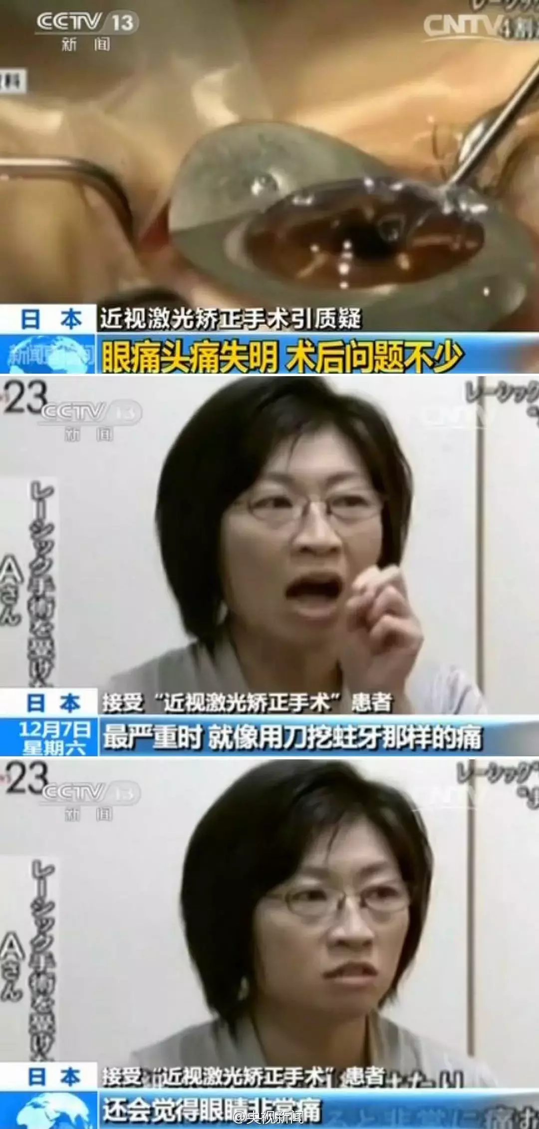 “近视手术毁了我”,他们选择自杀,原来这种手术比想象的危险!