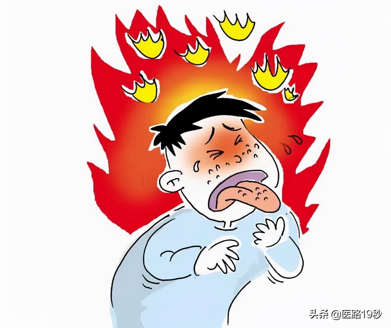 容易上火是什么原因(容易上火是什么原因造成的)