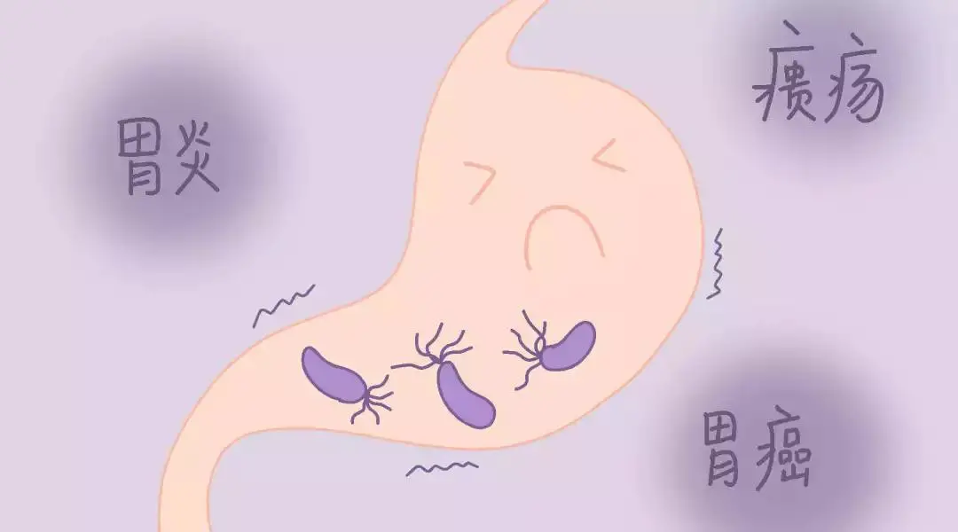 出现胃部不适时需要做哪些检查?这篇文章一次说清