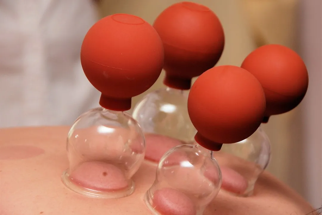 拔罐有哪些误区?