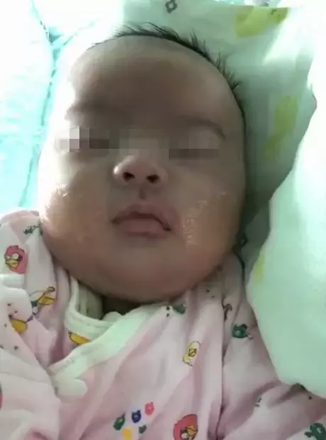 新生婴儿经历6次腰椎穿刺,险些没命!妈妈:4万2的月子中心,竟是骗人的