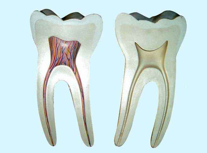 牙疼剧烈难以忍受，你可能是得了牙髓炎，得抓紧去“杀神经”了