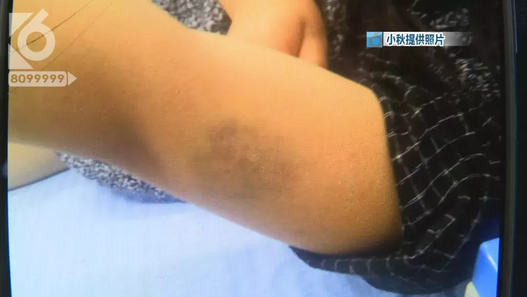 少女疑遭同学毒打  冷水泼醒逼迫下跪