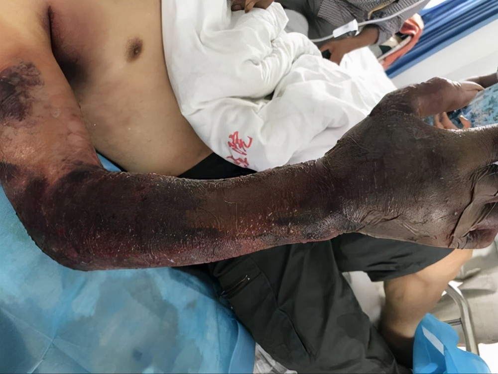 贵州一食堂惊现剧毒五步蛇!体型虽小,毒性却很猛,被咬了怎么办