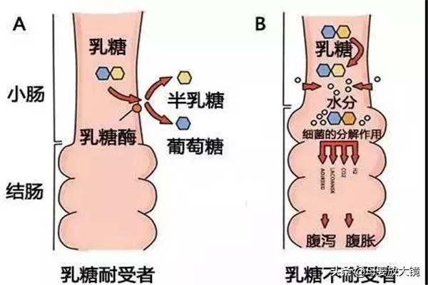 宝宝腹泻如何家庭护理？腹泻奶粉、益生菌、乳糖酶，哪一种更靠谱