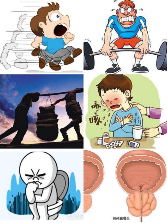 前言(本文着重聊聊腹股沟疝那些事)