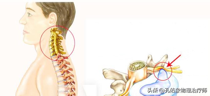 后背、肩胛骨内侧缘疼痛，是怎么回事？该如何处理？给您讲清楚