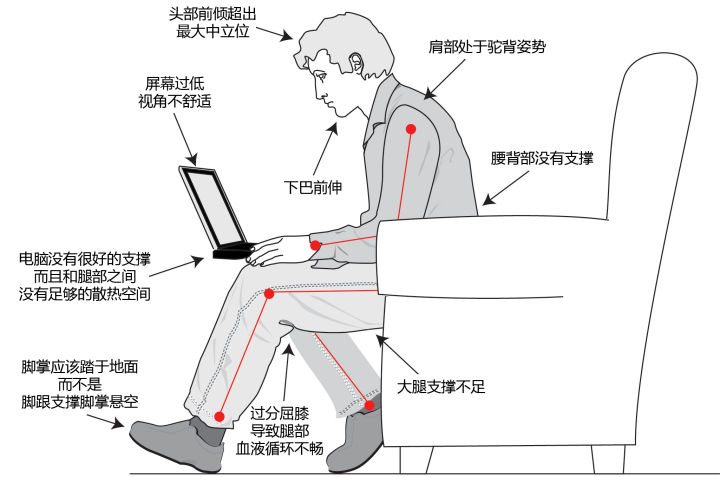 为什么久坐总是腰酸背痛？练好这个动作拯救你的骨盆前倾