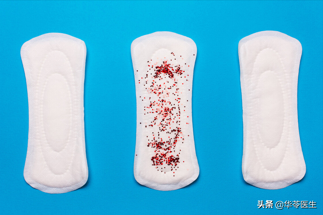 女性非经期出血,警惕这4种情况