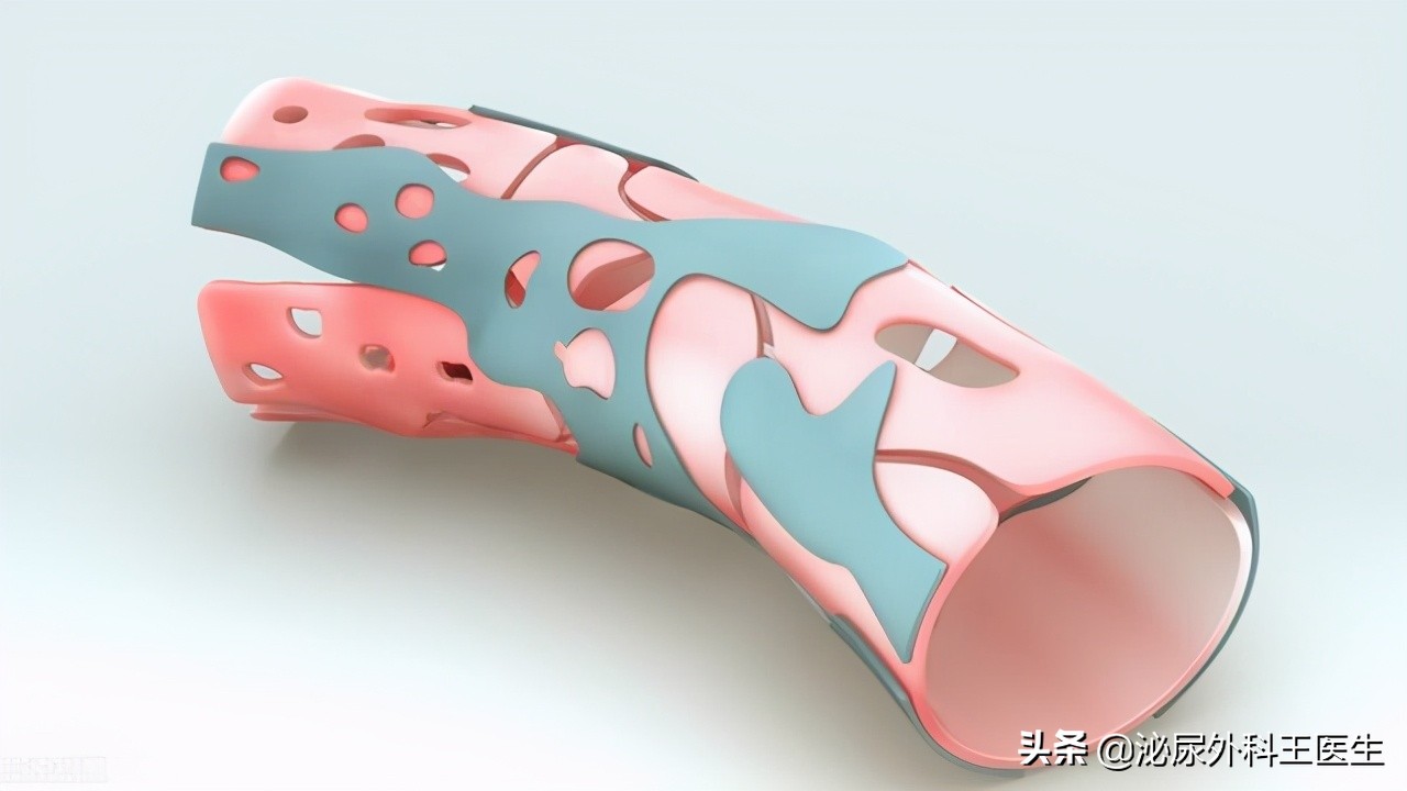 男性ED选择高剂量西地那非好，还是低剂量他达拉非好，听3点建议