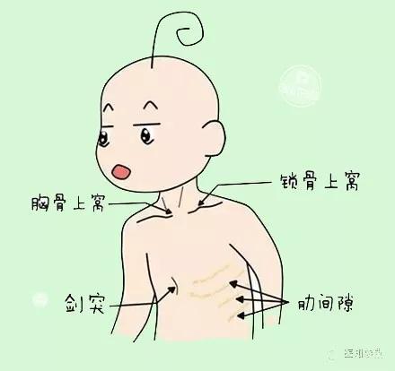 宝宝得了肺炎，必须用抗生素？怎么护理可以少遭罪？