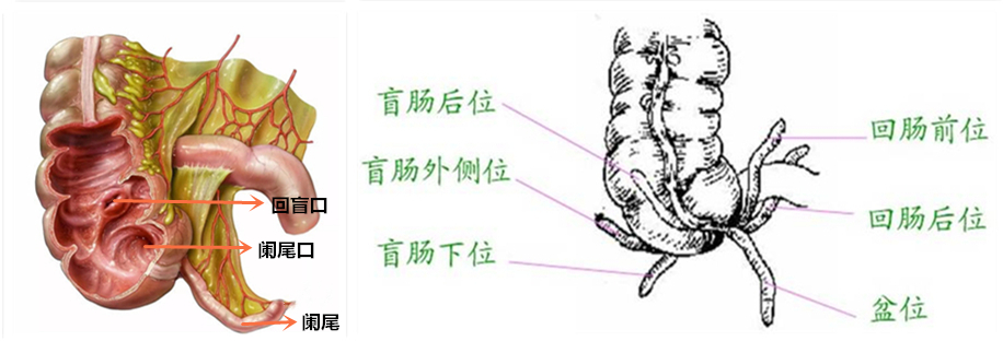 阑尾炎虽常见，但也需医生谨慎考虑：注意这几种特殊类型阑尾炎