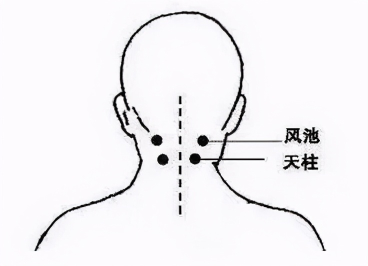 头痛反复难忍？自己动动手，3个妙招有效缓解
