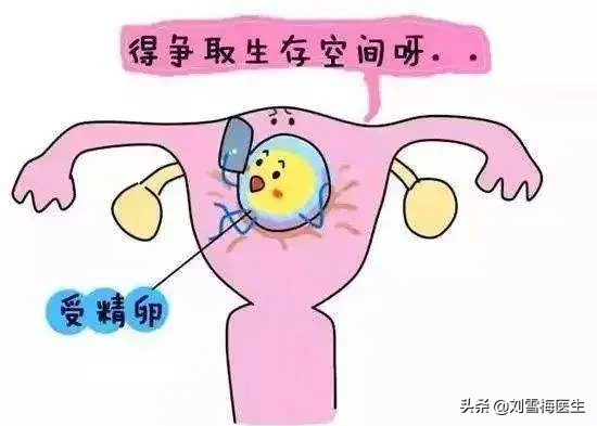 宫腔粘连得做手术才能治疗吗？医生说视情况而定