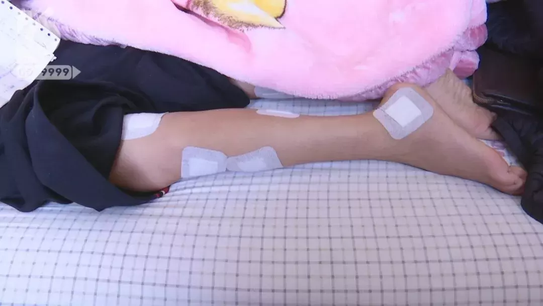 半小时治疗花费近5万 腹部肿瘤只需腿上扎针就能治疗?
