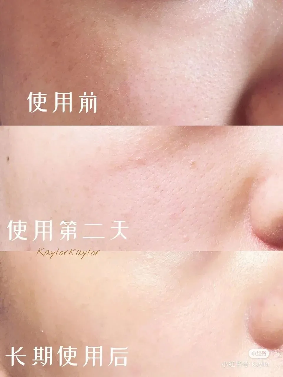 新款雅诗兰黛智妍抗衰老三件套，25+开始抗皱抗老超级推荐的套盒