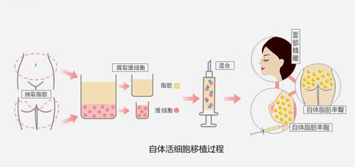 苹果肌是什么？ 怎么才能打造出饱满苹果肌？