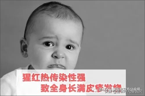 小儿猩红热不正规治疗危害大