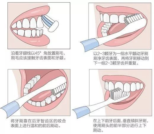 刷牙的正确方法 刷牙一天要刷两次，早晚各一次