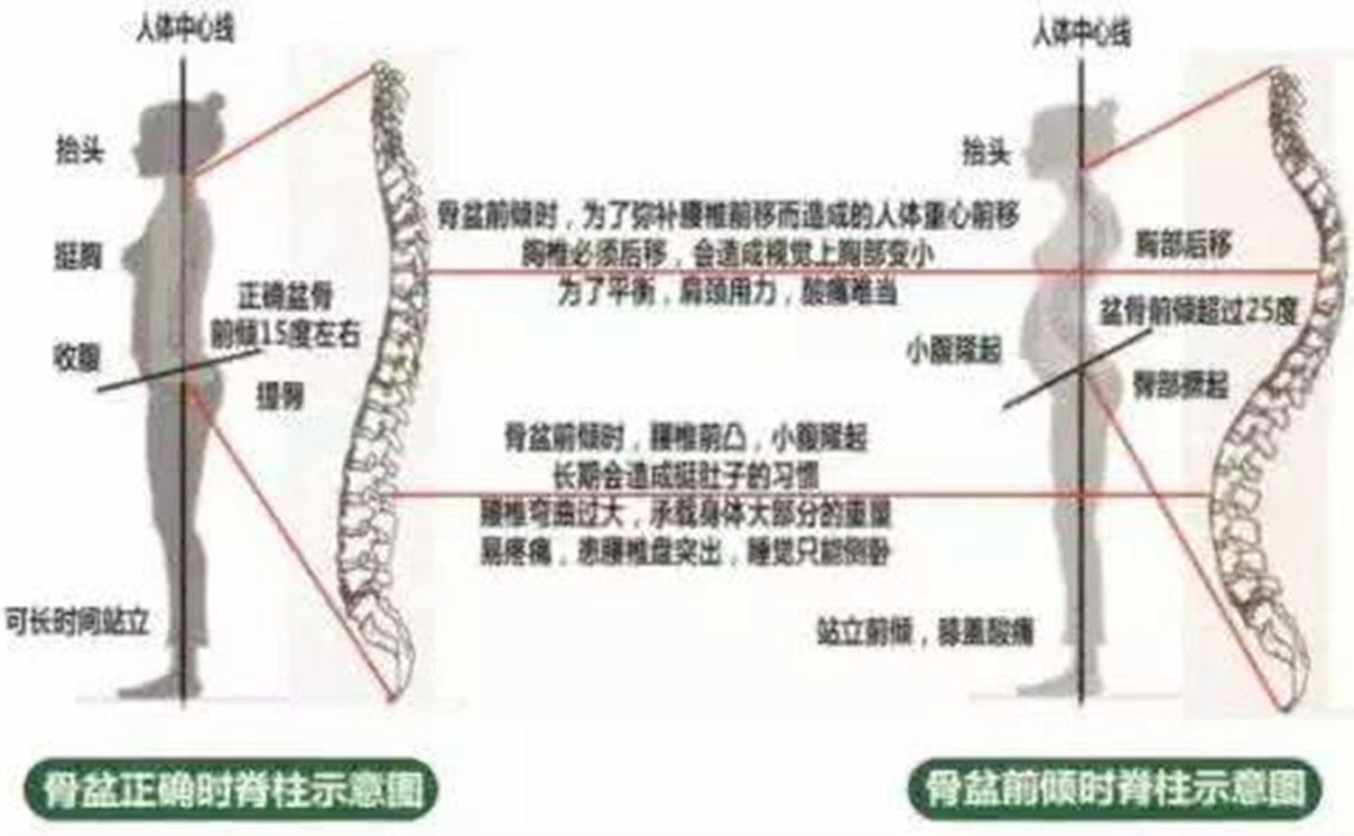 关于腰凳，讲了很多不利宝宝发育的错误姿势，却忘了对妈妈的伤害