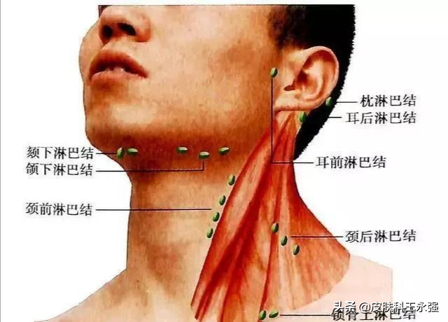 淋巴结出现这几个异常，暗示身体有病？对照看看，以免恶变