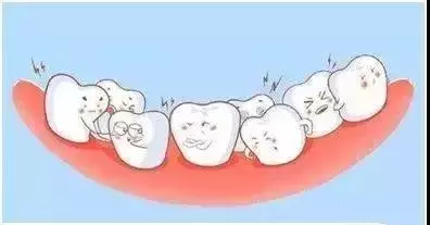 牙齿名称结构图28颗牙（揭秘每颗牙齿的名字）