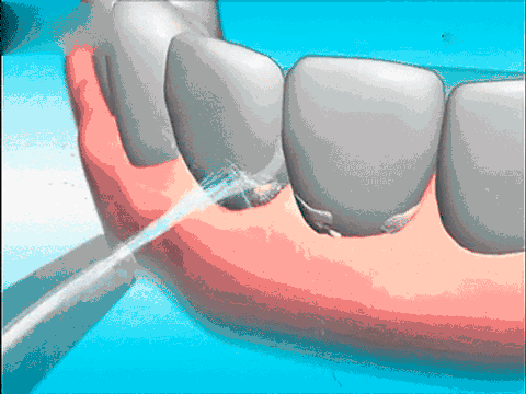 牙医揭秘：花几十到几百块洗一次牙有没有意义？洗牙难道很暴利？