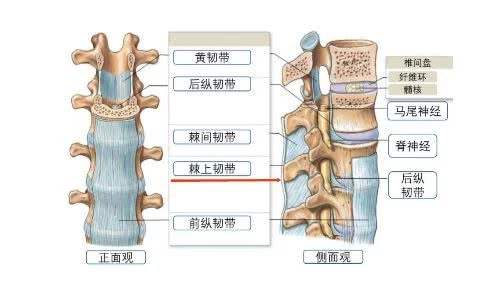 后背中间脊柱疼，不是心脏病，是棘上韧带炎，医生说想根治多运动